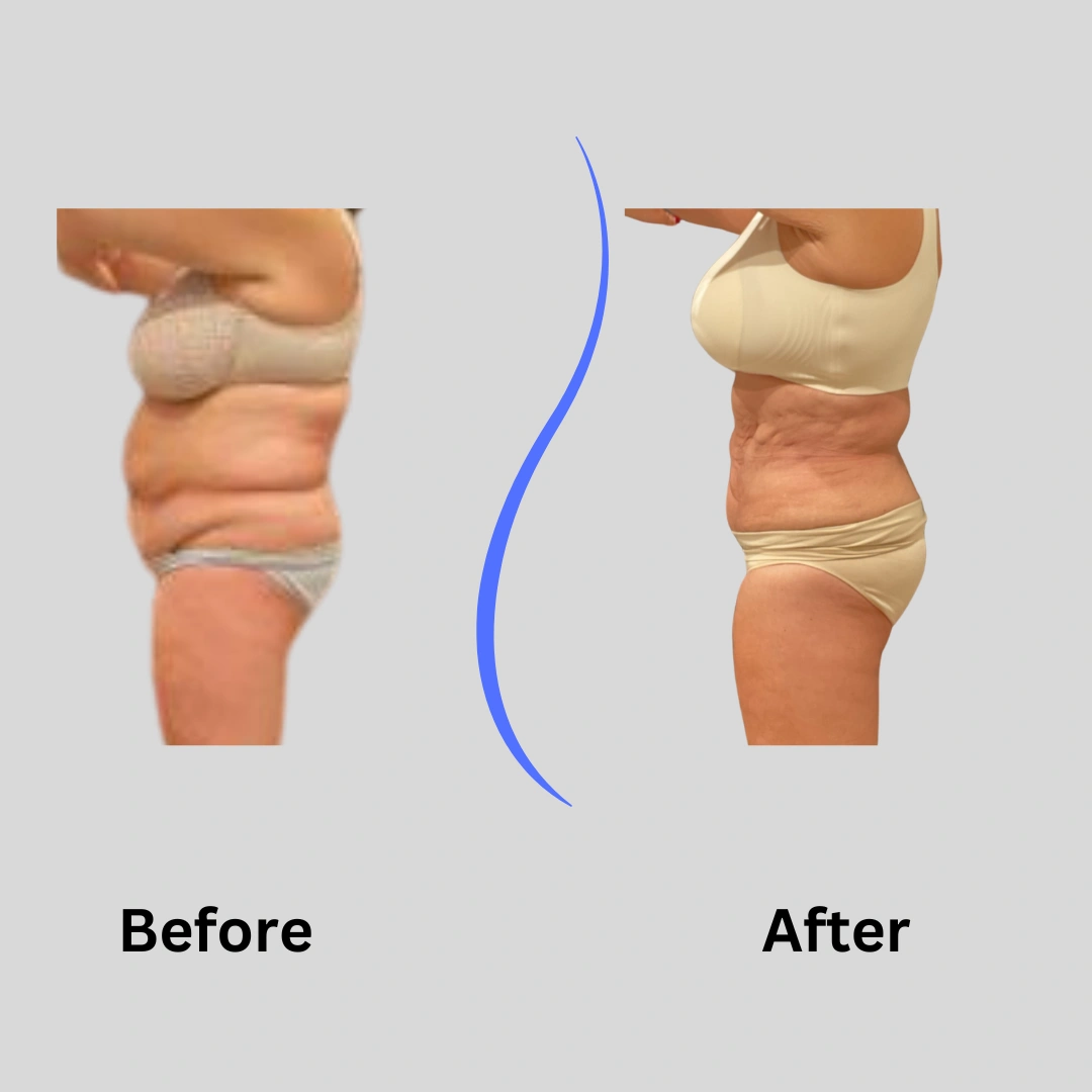 Real Patient Results preformed by Dr. Ryan Mcgovern in Brookfield and Appleton, WI.