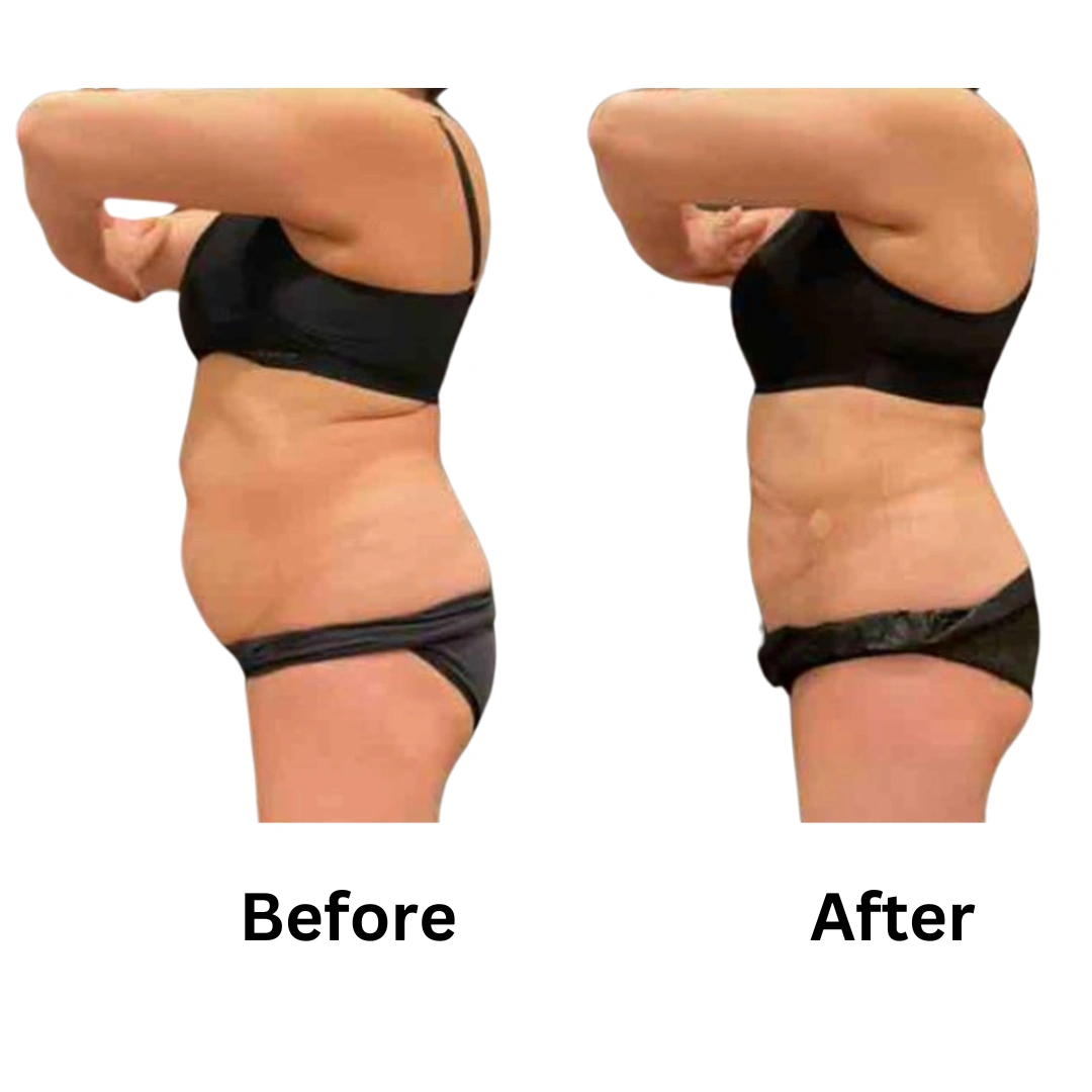 Real Patient Results preformed by Dr. Ryan Mcgovern in Brookfield and Appleton, WI.