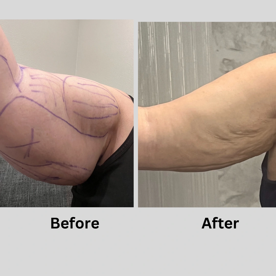 Real Patient Results preformed by Dr. Ryan Mcgovern in Brookfield and Appleton, WI.