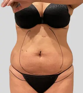 Real patient results In Appleton, Brookfield, Milwaukee, WI & Gurnee, IL