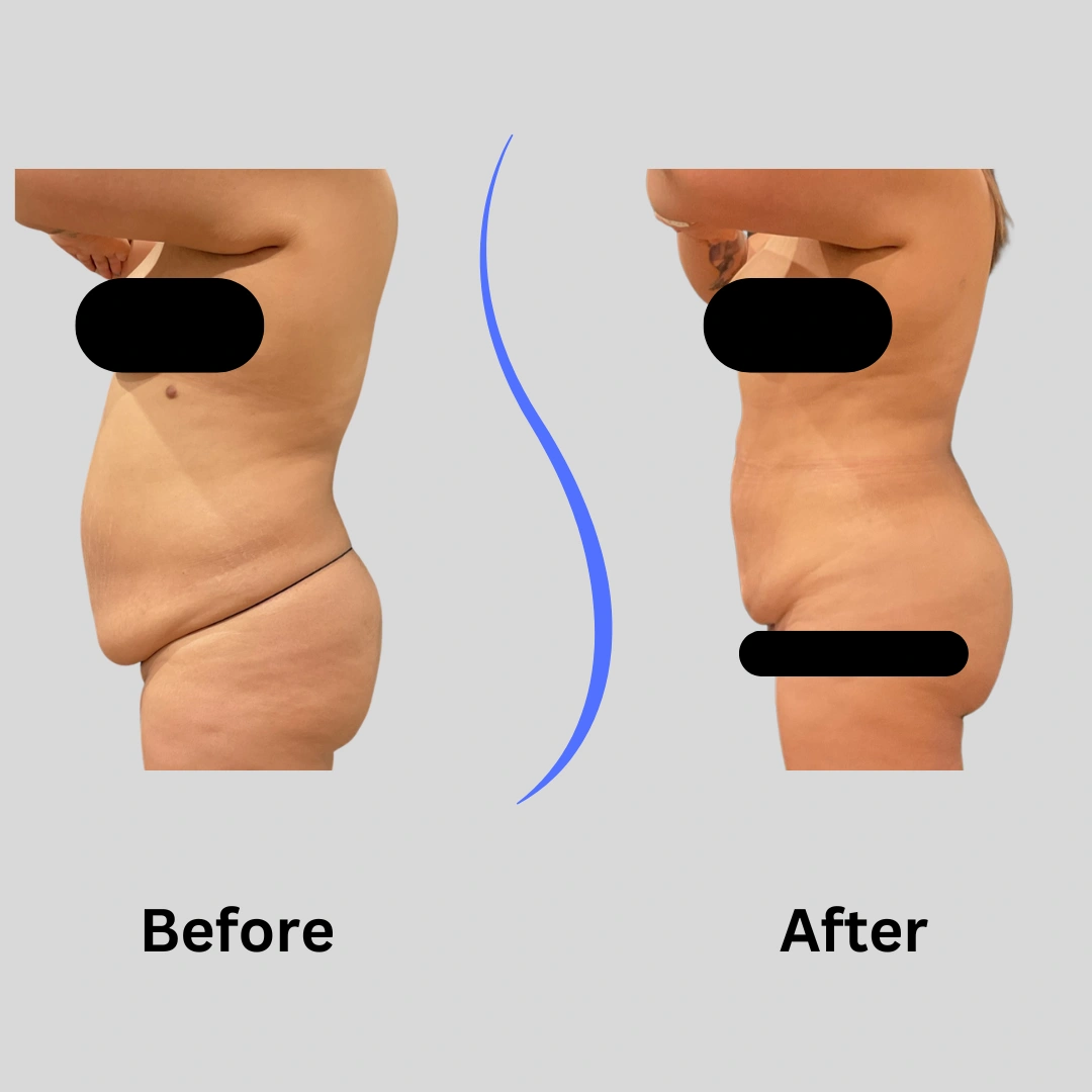 Real Patient Results preformed by Dr. Ryan Mcgovern in Brookfield and Appleton, WI.