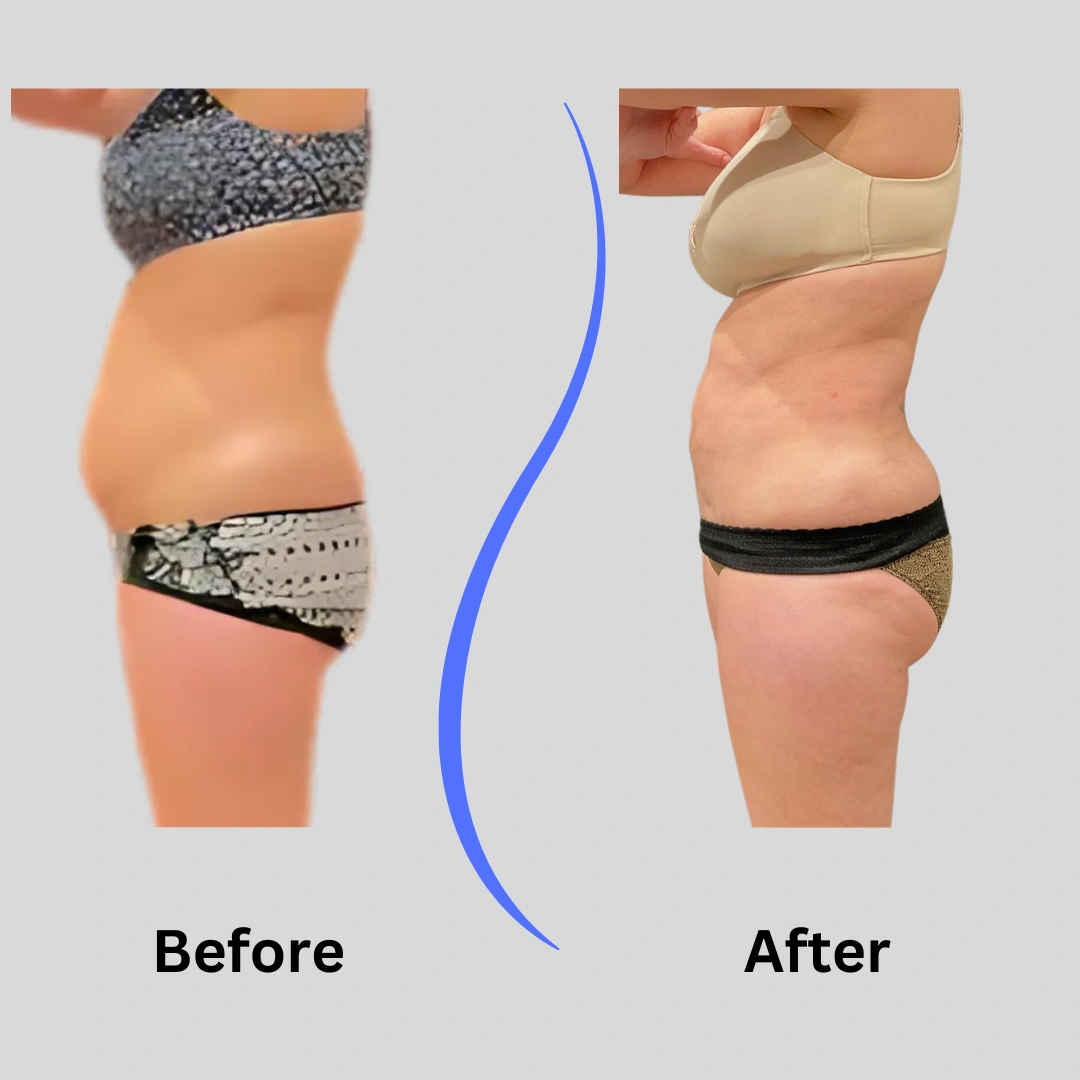 Real Patient Results preformed by Dr. Ryan Mcgovern in Brookfield and Appleton, WI.
