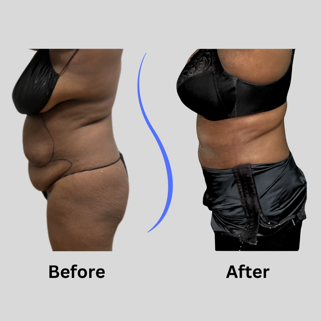 Real Patient Results preformed by Dr. Ryan Mcgovern in Brookfield and Appleton, WI.