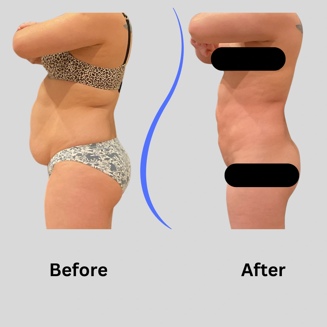 Real Patient Results preformed by Dr. Ryan Mcgovern in Brookfield and Appleton, WI.