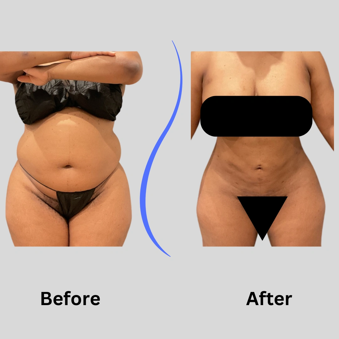 Real Patient Results preformed by Dr. Ryan Mcgovern in Brookfield and Appleton, WI.