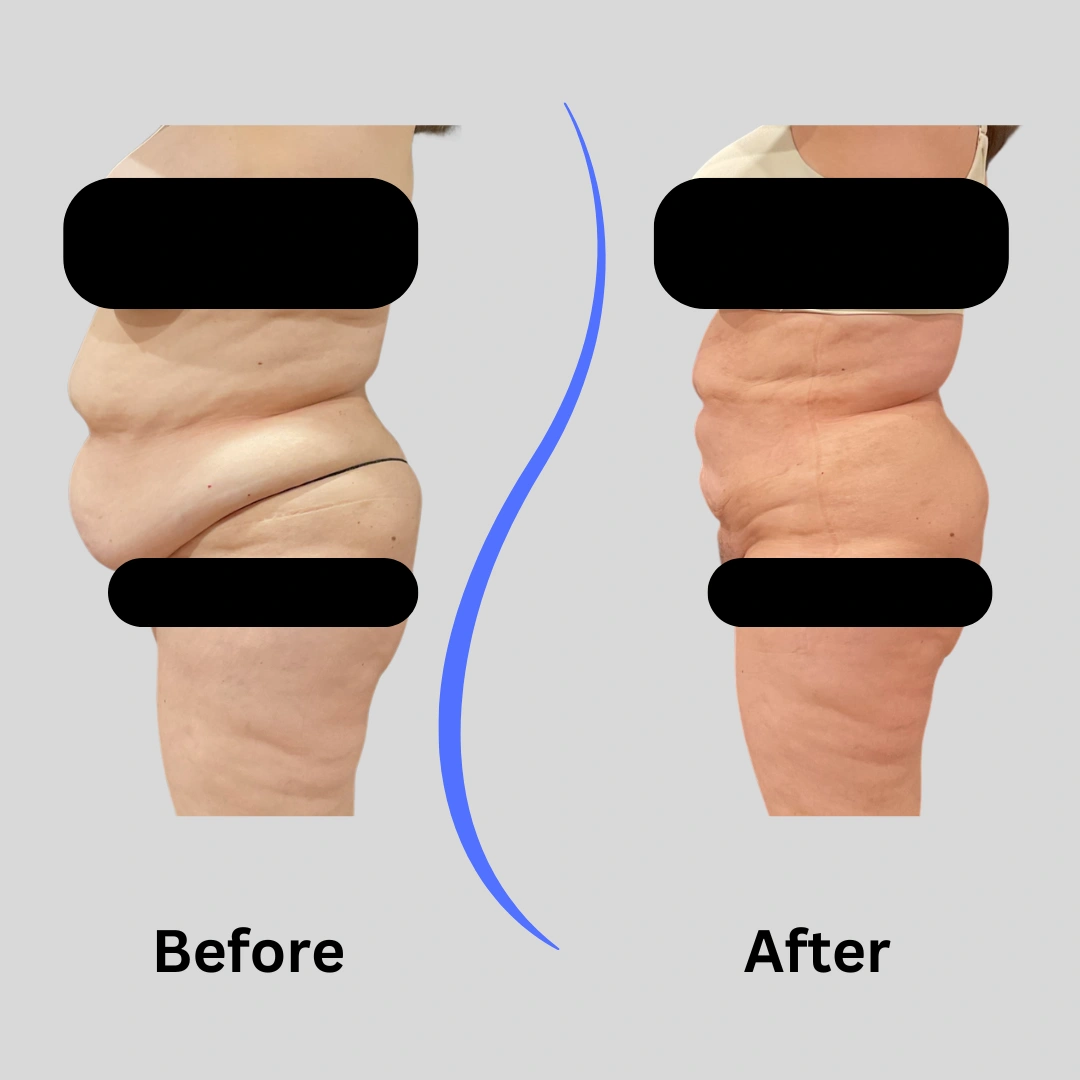 Real patient results In Appleton, Brookfield, Milwaukee, WI & Gurnee, IL