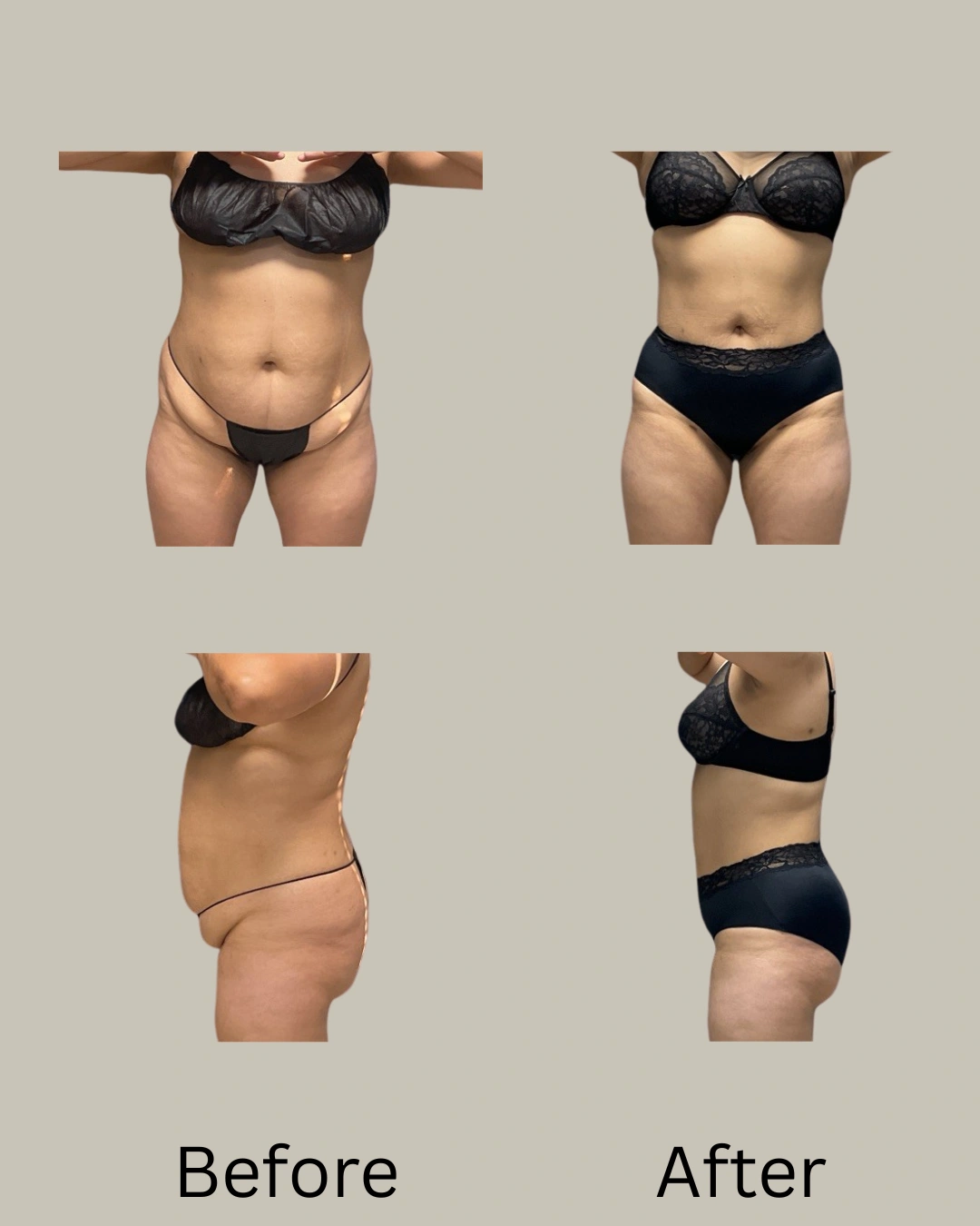 Real patient results In Appleton, Brookfield, Milwaukee, WI & Gurnee, IL