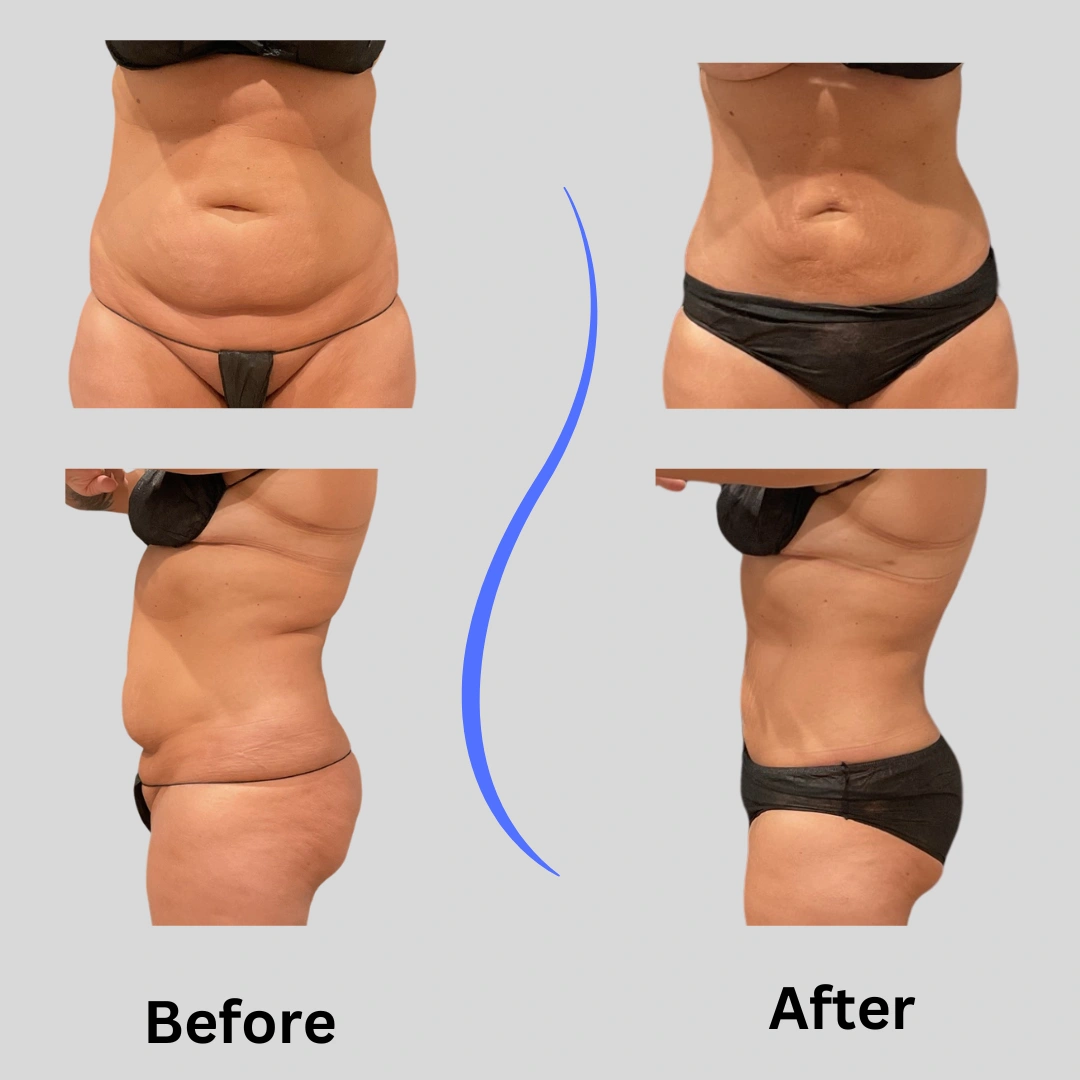 Real patient results In Appleton, Brookfield, Milwaukee, WI & Gurnee, IL