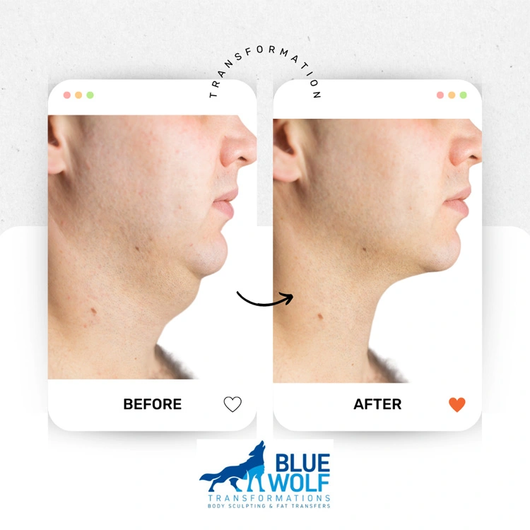 Real patient results In Appleton, Brookfield, Milwaukee, WI & Gurnee, IL