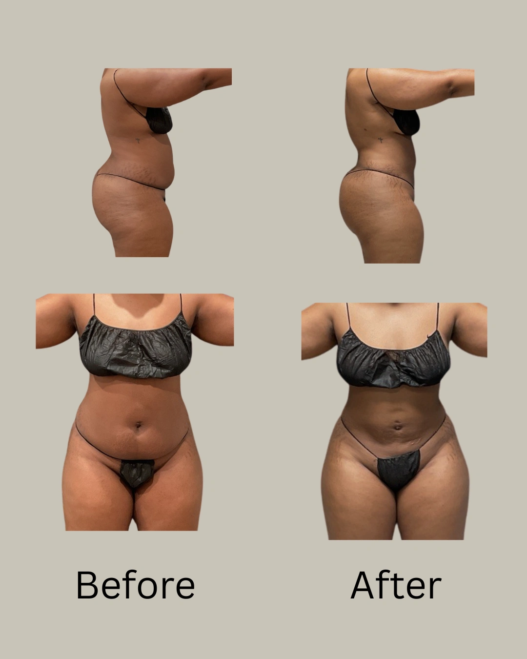 Real patient results In Appleton, Brookfield, Milwaukee, WI & Gurnee, IL