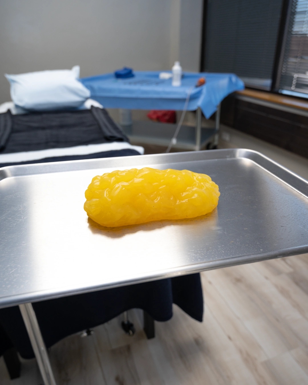 Yellow fat on stainless steel medical examination table in modern clinic treatment room - In Appleton, Brookfield, Milwaukee, WI & Gurnee, IL