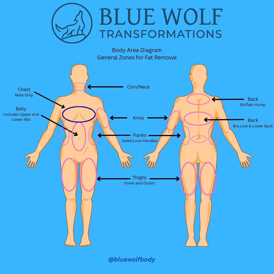 Body measurement diagram showing front and back view with labeled points for fat removal procedure by Blue Wolf Transforma...