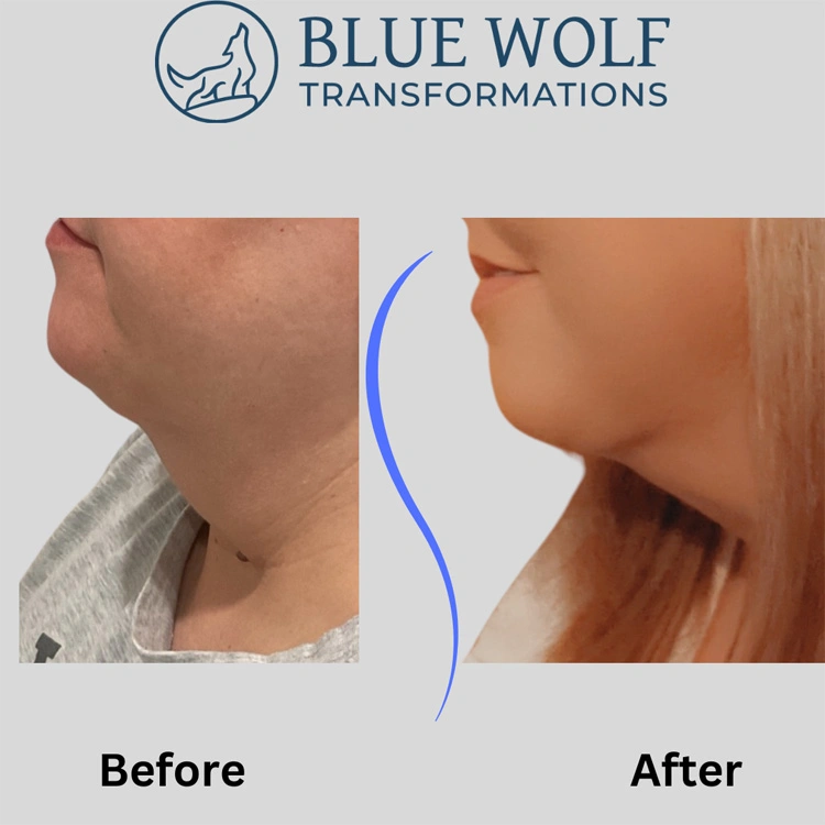 Real patient results In Appleton, Brookfield, Milwaukee, WI & Gurnee, IL