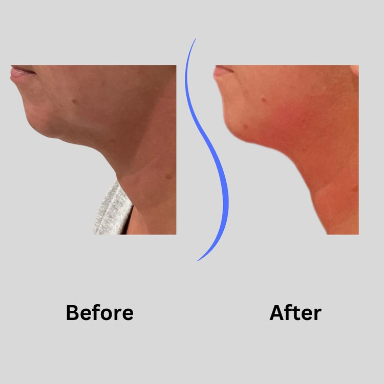 Real patient results In Appleton, Brookfield, Milwaukee, WI & Gurnee, IL