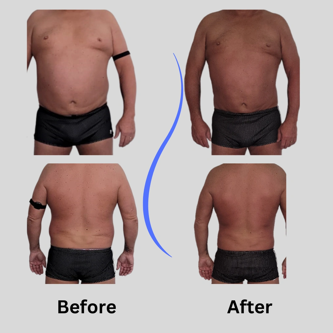 Real patient results In Appleton, Brookfield, Milwaukee, WI & Gurnee, IL