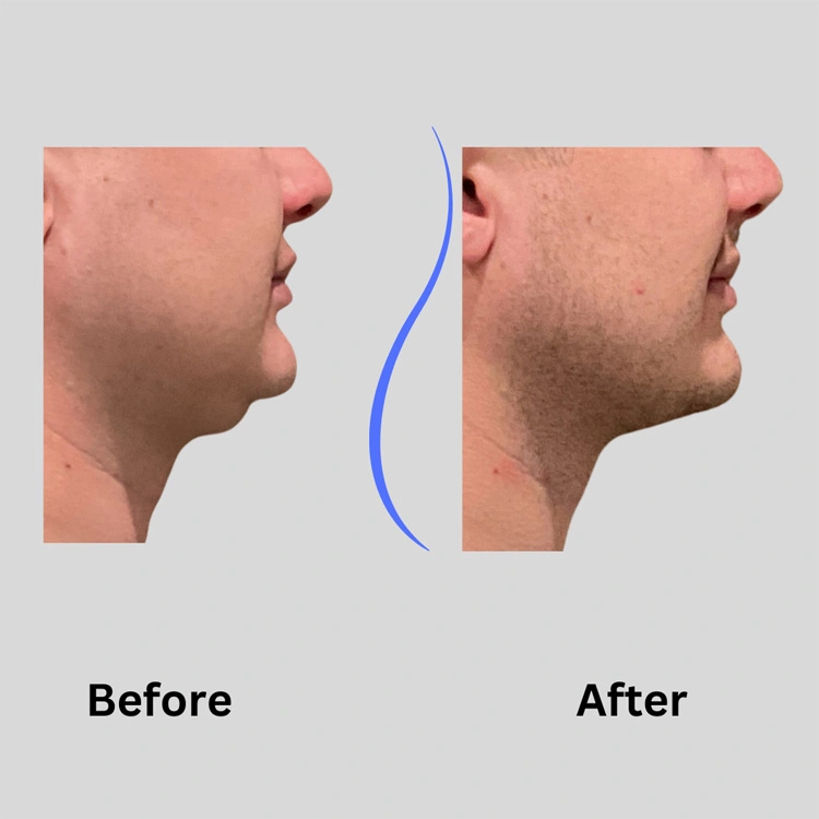 Real patient results In Appleton, Brookfield, Milwaukee, WI & Gurnee, IL