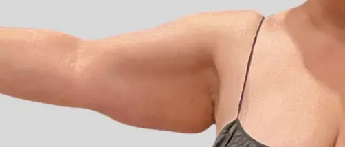 Real patient results In Appleton, Brookfield, Milwaukee, WI & Gurnee, IL