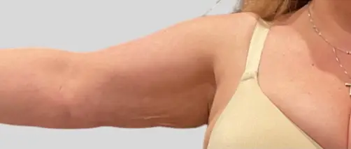 Real patient results In Appleton, Brookfield, Milwaukee, WI & Gurnee, IL