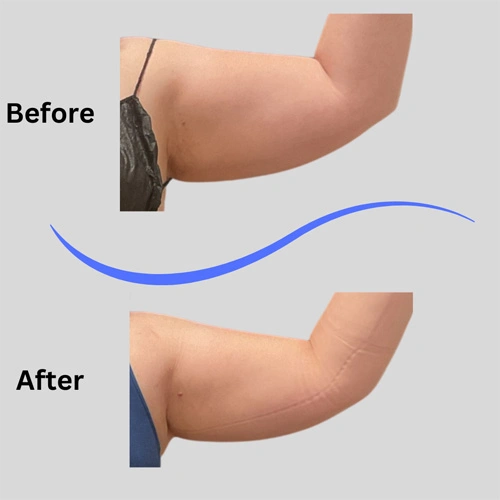 Real patient results In Appleton, Brookfield, Milwaukee, WI & Gurnee, IL