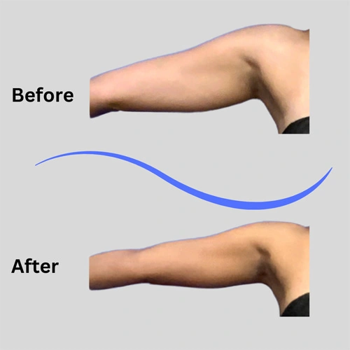 Real patient results In Appleton, Brookfield, Milwaukee, WI & Gurnee, IL