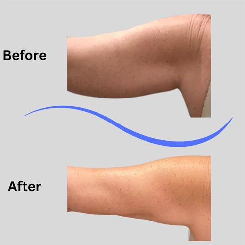 Real patient results In Appleton, Brookfield, Milwaukee, WI & Gurnee, IL