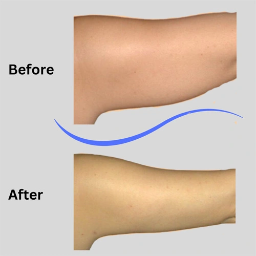 Real patient results In Appleton, Brookfield, Milwaukee, WI & Gurnee, IL