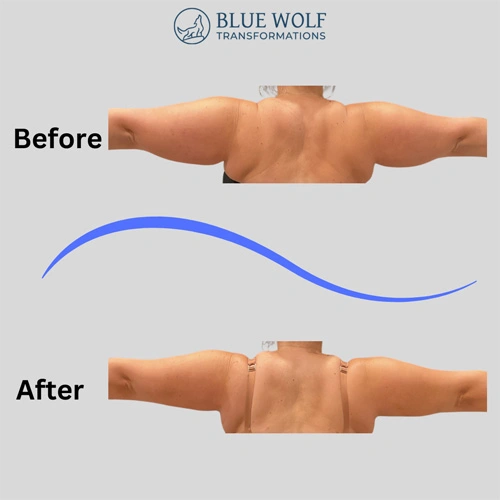 Real patient results In Appleton, Brookfield, Milwaukee, WI & Gurnee, IL