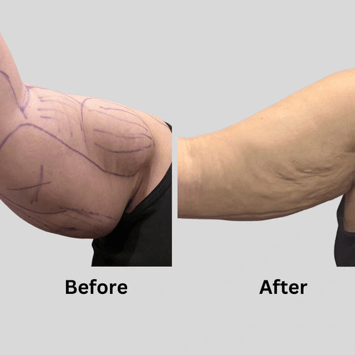 Real patient results In Appleton, Brookfield, Milwaukee, WI & Gurnee, IL