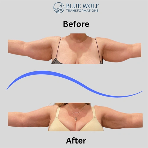 Real patient results In Appleton, Brookfield, Milwaukee, WI & Gurnee, IL