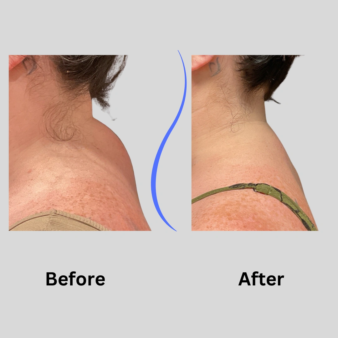 Real patient results In Appleton, Brookfield, Milwaukee, WI & Gurnee, IL