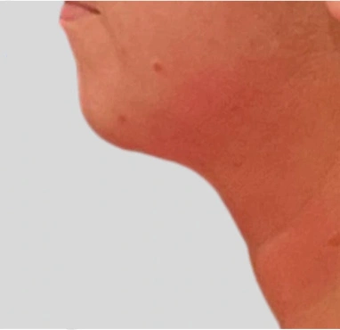 Real patient results In Appleton, Brookfield, Milwaukee, WI & Gurnee, IL