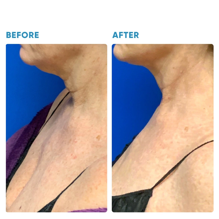 Real patient results In Appleton, Brookfield, Milwaukee, WI & Gurnee, IL