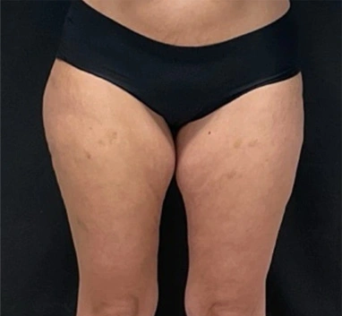 Real patient results In Appleton, Brookfield, Milwaukee, WI & Gurnee, IL