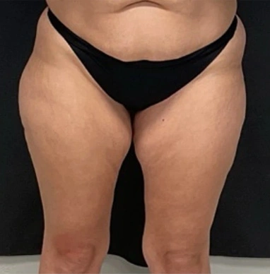 Real patient results In Appleton, Brookfield, Milwaukee, WI & Gurnee, IL