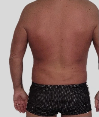 Real patient results In Appleton, Brookfield, Milwaukee, WI & Gurnee, IL