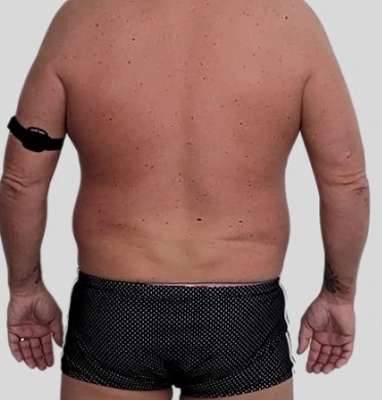 Real patient results In Appleton, Brookfield, Milwaukee, WI & Gurnee, IL