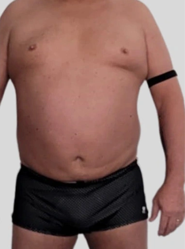 male-before-front