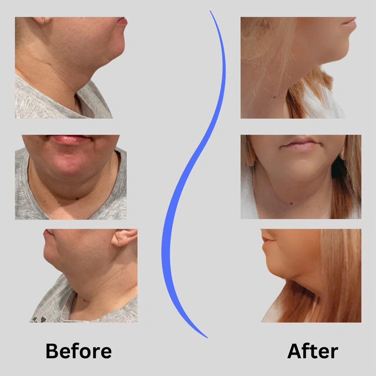 Real patient results In Appleton, Brookfield, Milwaukee, WI & Gurnee, IL
