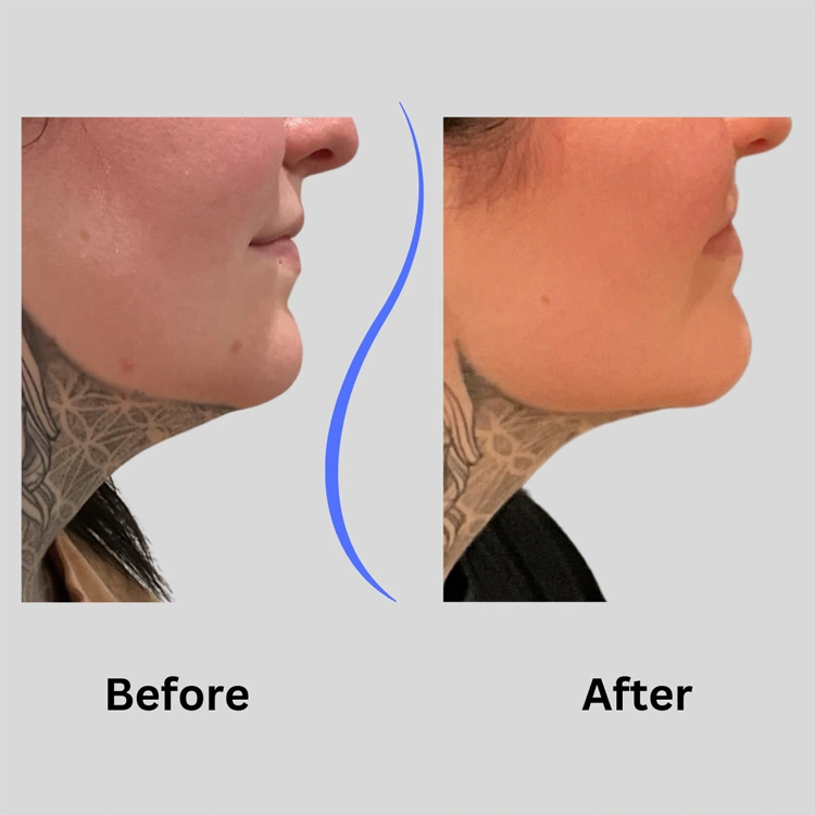 Real patient results In Appleton, Brookfield, Milwaukee, WI & Gurnee, IL