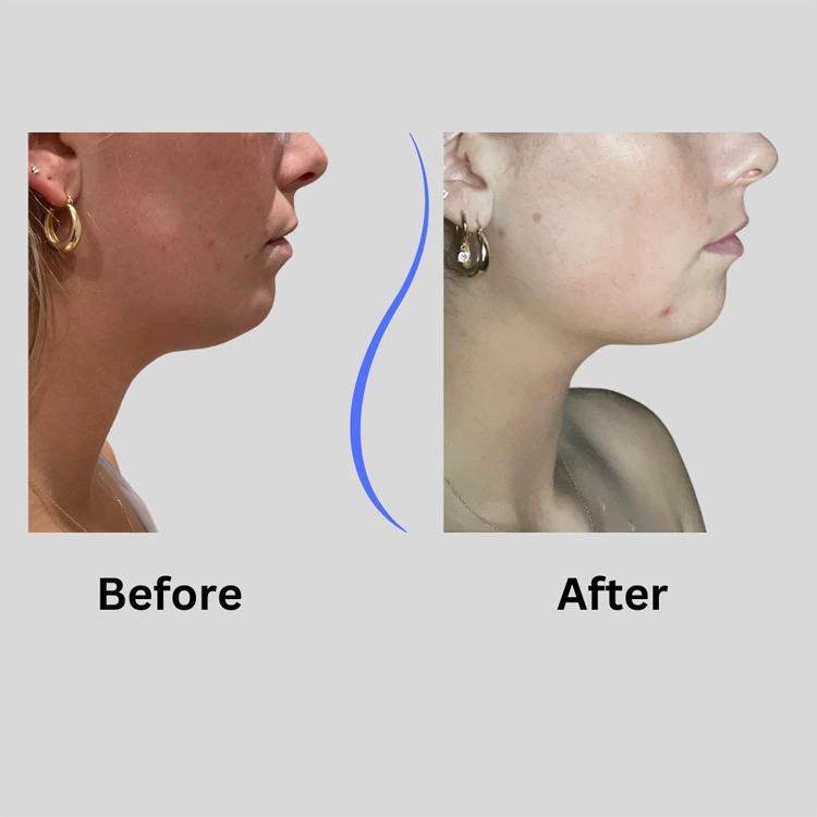 Real patient results In Appleton, Brookfield, Milwaukee, WI & Gurnee, IL