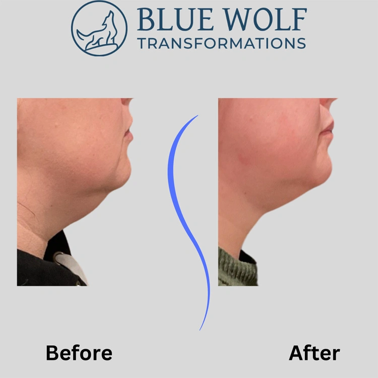 Real patient results In Appleton, Brookfield, Milwaukee, WI & Gurnee, IL