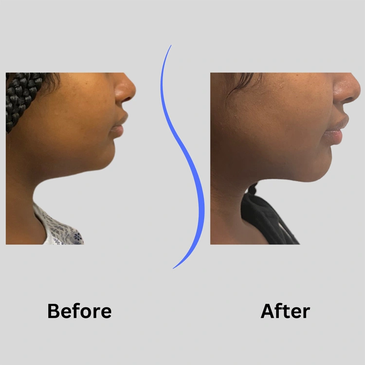 Real patient results In Appleton, Brookfield, Milwaukee, WI & Gurnee, IL