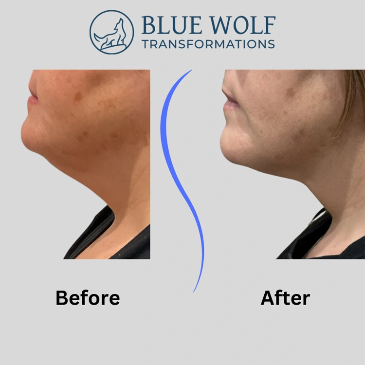 Real patient results In Appleton, Brookfield, Milwaukee, WI & Gurnee, IL