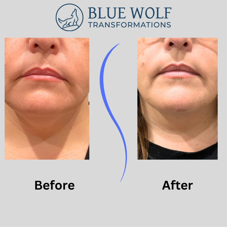 Real patient results In Appleton, Brookfield, Milwaukee, WI & Gurnee, IL