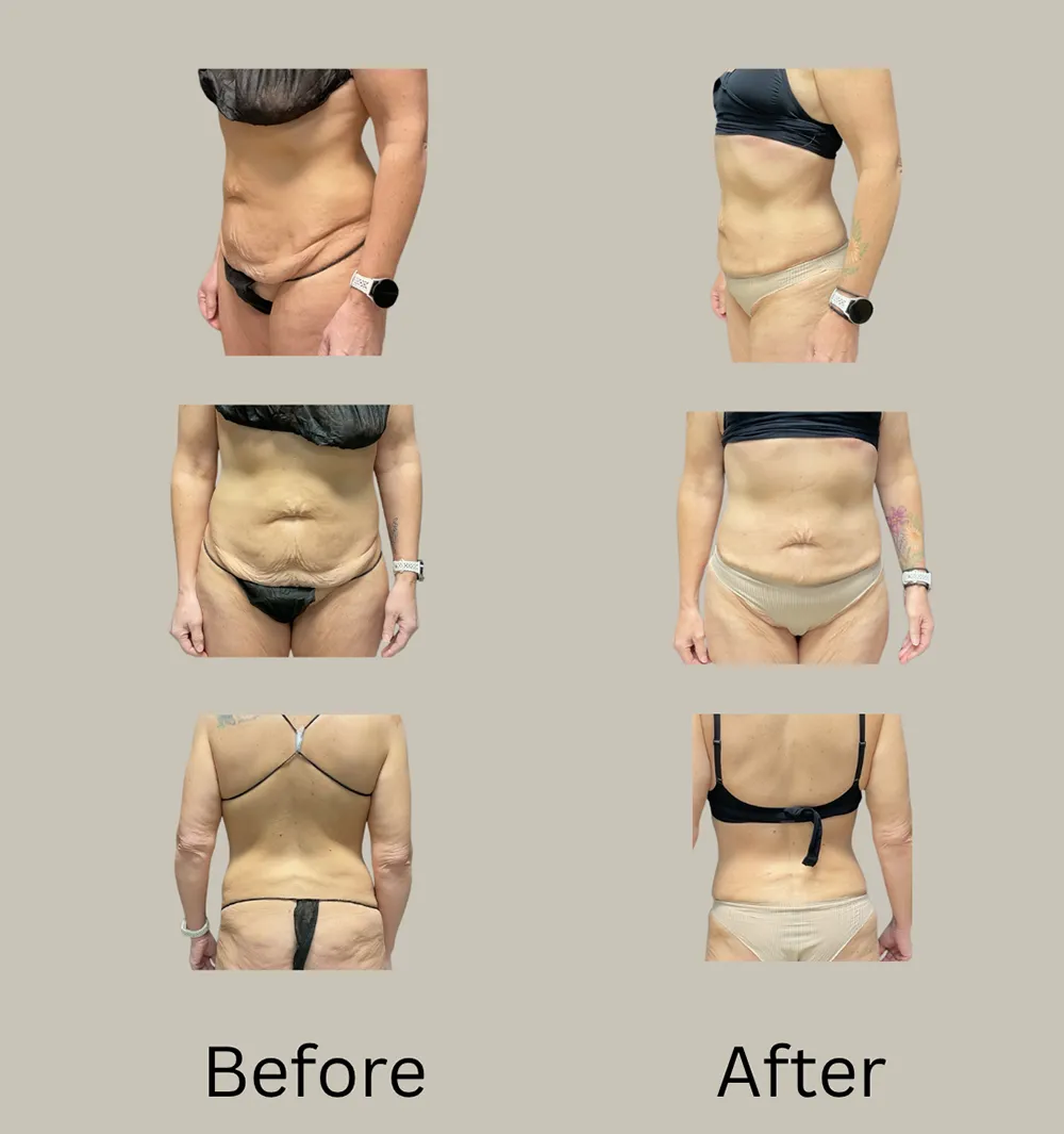 JM 360 before after (1)