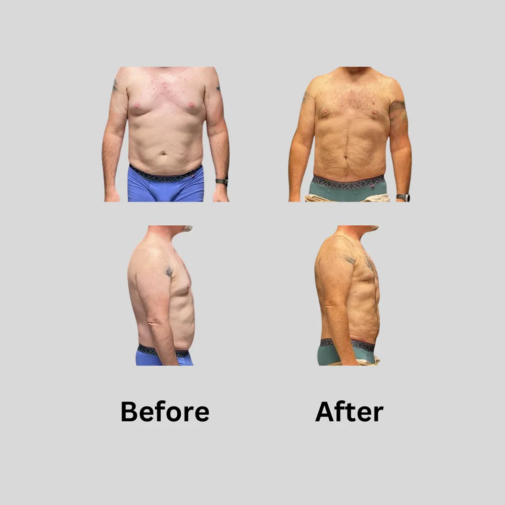 dadbod b4 after